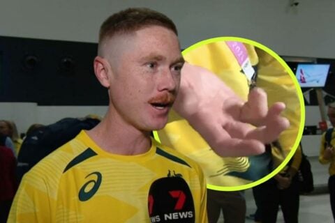 Australian Olympian Matt Dawson Amputates His Finger To Compete In Paris 2024